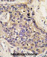 PAB3683 - Hepatocyte growth factor / HGF