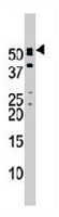 PAB3709 - NUP50