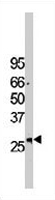 PAB3740 - EIF2B3