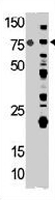 PAB3751 - ACO2