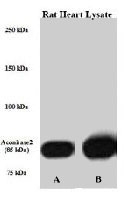 PAB3751 - ACO2