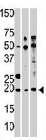 PAB3754 - RPL23A
