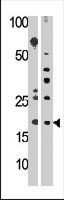 PAB3755 - RPL23A