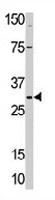 PAB3757 - MRPL24