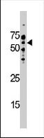 PAB3760 - CSTF2