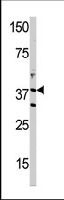 PAB3765 - DIMT1L