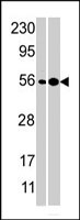 PAB3770 - NMD3