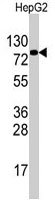 PAB3774 - EIF4B