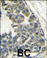 PAB3774 - EIF4B