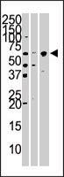 PAB3804 - KPNA4 / Importin alpha-4