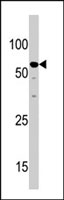 PAB3814 - NCAPH2
