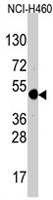 PAB3818 - TFAP2A / AP-2 alpha