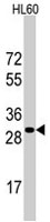 PAB3819 - RPS6