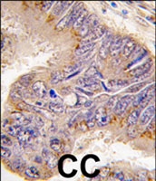 PAB3819 - RPS6