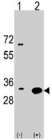PAB3819 - RPS6