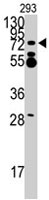 PAB3822 - ZNF219