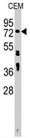 PAB3823 - ZNF219