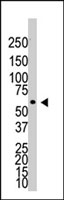 PAB3831 - CD292 / BMPR1A
