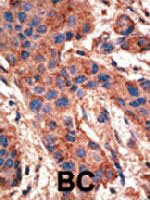 PAB3831 - CD292 / BMPR1A