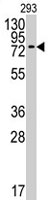PAB3833 - CD292 / BMPR1A