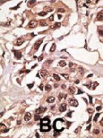 PAB3833 - CD292 / BMPR1A