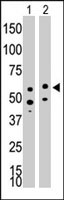 PAB3834 - CD292 / BMPR1A
