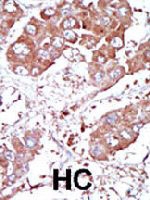 PAB3834 - CD292 / BMPR1A
