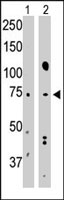 PAB3835 - CD292 / BMPR1A