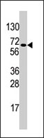 PAB3836 - CD292 / BMPR1A