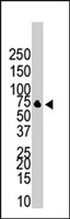 PAB3838 - CDw293 / BMPR1B