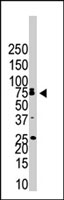 PAB3839 - CDw293 / BMPR1B