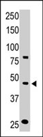 PAB3841 - CCBP2