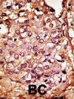PAB3841 - CCBP2