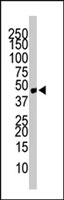 PAB3842 - CCBP2