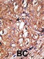 PAB3846 - CD73