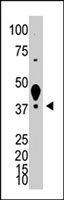 PAB3847 - LYVE-1