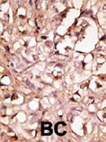PAB3847 - LYVE-1