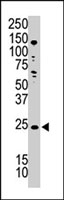 PAB3850 - Podoplanin