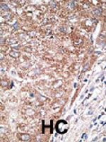 PAB3857 - NEUROD1
