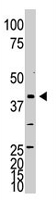 PAB3858 - NEUROD1