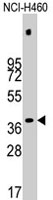 PAB3861 - PDHX / PDX1