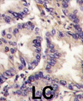 PAB3867 - VEGF-C / Flt4-L