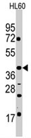 PAB3870 - OCT3/4