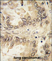 PAB3876 - SOX2