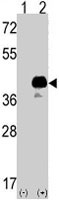 PAB3876 - SOX2