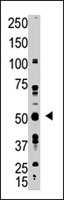 PAB3881 - BMP3B / GDF10