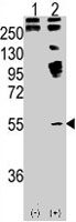 PAB3882 - BMP11 / GDF11