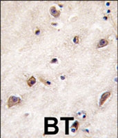 PAB3884 - GDF1