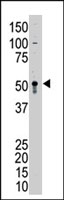PAB3885 - BMP9