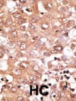 PAB3885 - BMP9